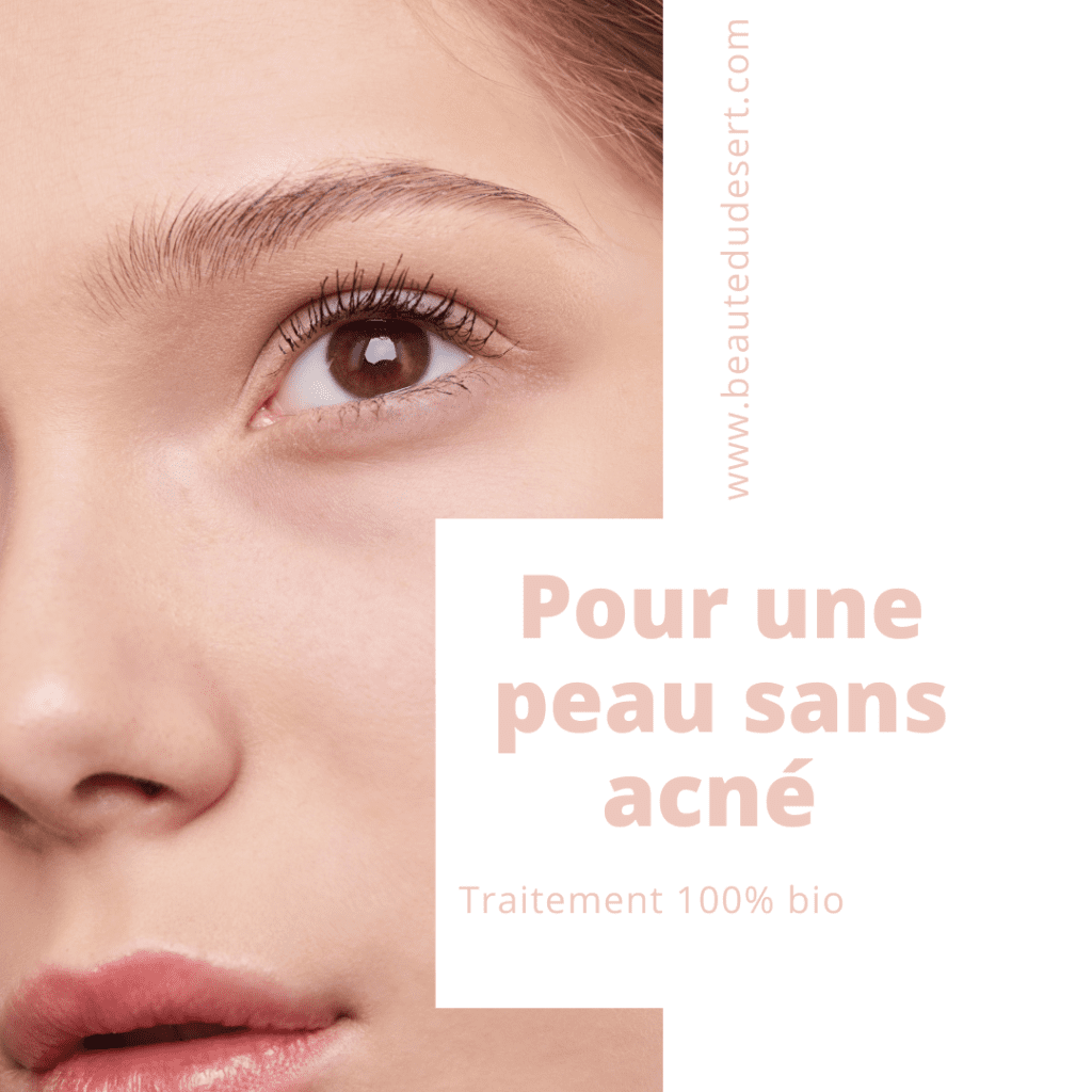 comment traiter votre problème d'acné - comment traiter l'acné naturellement? beauté du désert