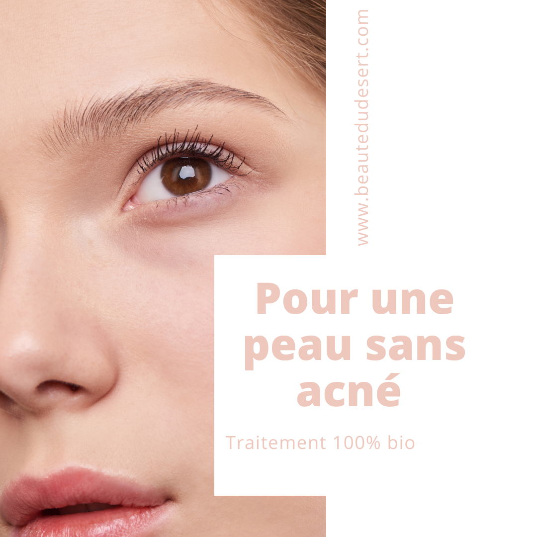 comment traiter votre problème d'acné ?- traitement naturel de l'acné - beauté du désert